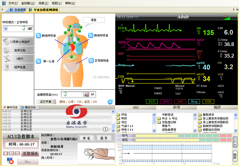  高智能數(shù)字化綜合急救技能訓(xùn)練系統(tǒng)（ACLS高級(jí)生命支持、計(jì)算機(jī)軟件控制）
